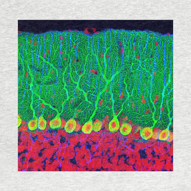 Purkinje nerve cells in the cerebellum (P360/0474) by SciencePhoto